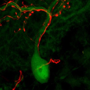 Scientific image of green and red brain activity against a black background.