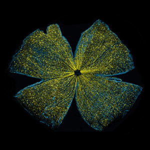 Scientific image of a rodent’s retina that resembles a yellow flower.